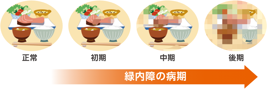 視野が欠けるイメージ