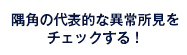 隅角の代表的な異常所見をチェックする！