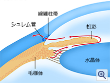 開放隅角