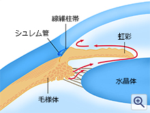 閉塞隅角