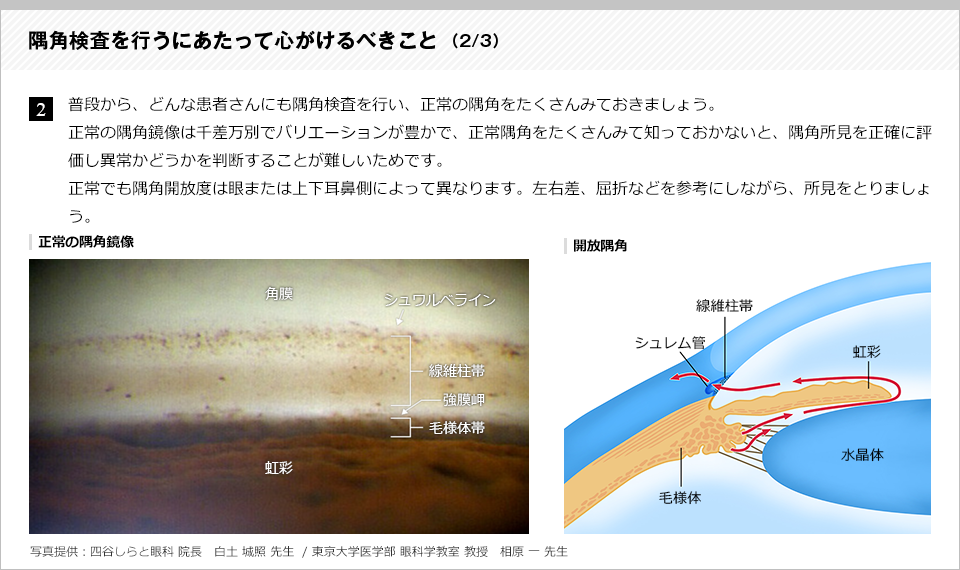 隅角検査を行うにあたって心がけるべきこと2