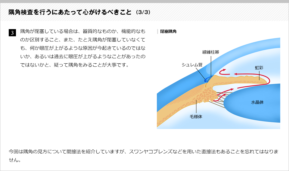 隅角検査を行うにあたって心がけるべきこと3