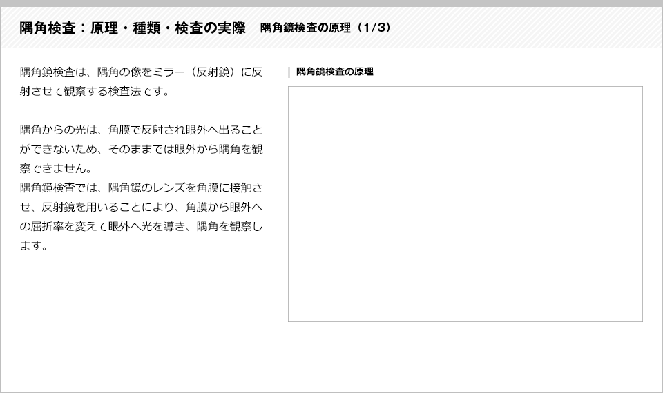 隅角検査：原理・種類・検査の実際1