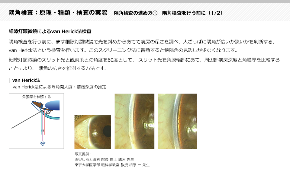 隅角検査：原理・種類・検査の実際12