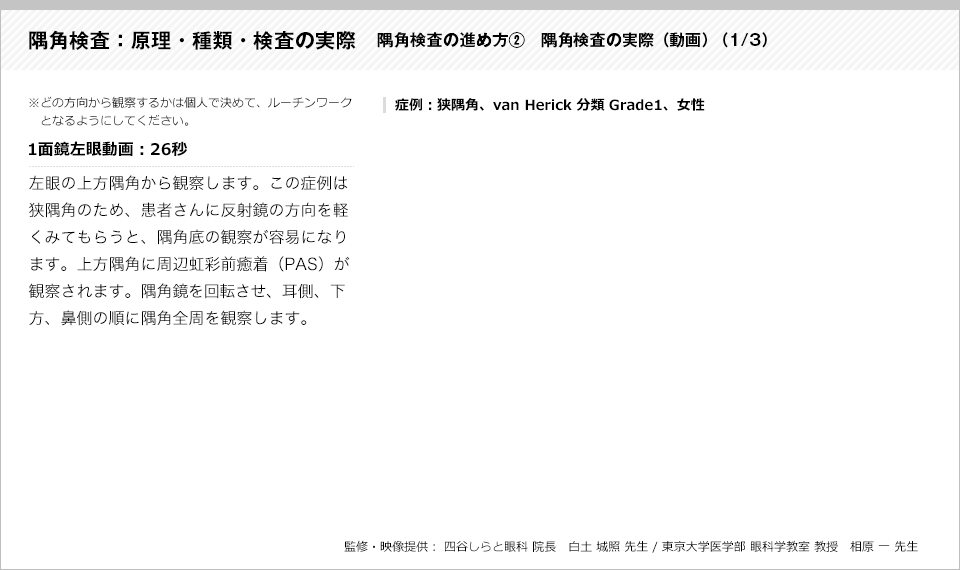 隅角検査：原理・種類・検査の実際14