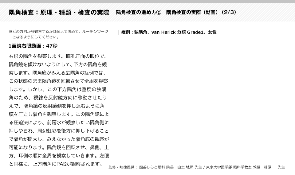 隅角検査：原理・種類・検査の実際15