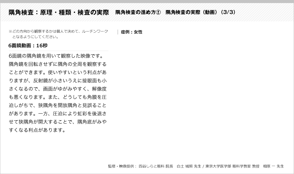 隅角検査：原理・種類・検査の実際16